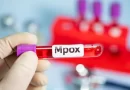 Mpox: Fundação de Saúde alinha estratégias com unidades para atuação em possíveis casos no AP